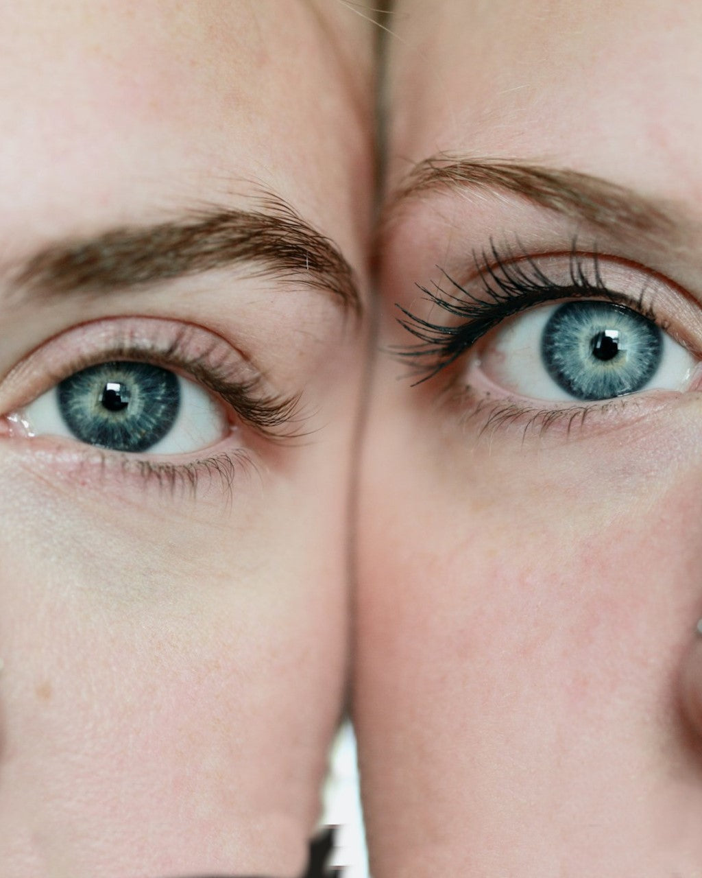 Cosmetic Eyeliner Tattooing